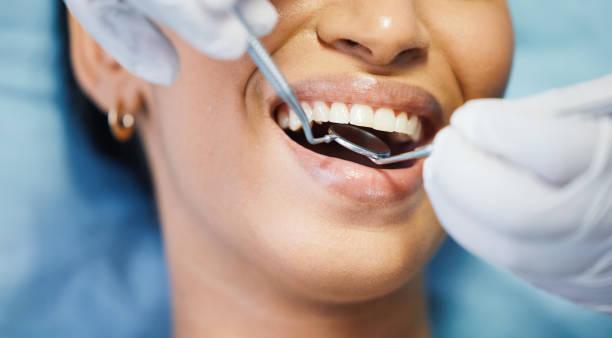 Best Emergency Wisdom Teeth Removal in Belleview, FL
